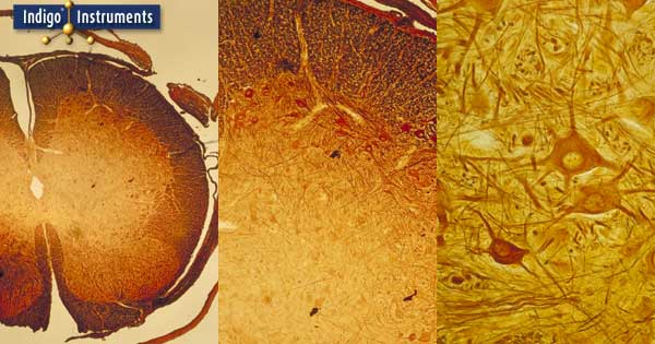 Cajal stain of spinal cord