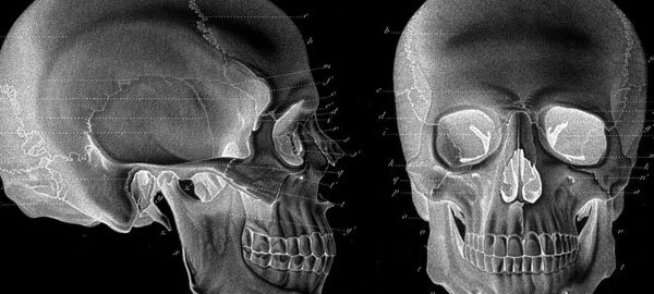 3D Printed Bones